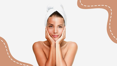 Glutathione Injections for Whiter Skin: Made In Heaven Highlights Dangers of Unregulated Cosmetic Procedures